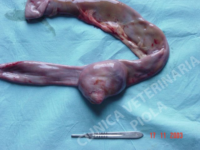 Neoplasia intestinale